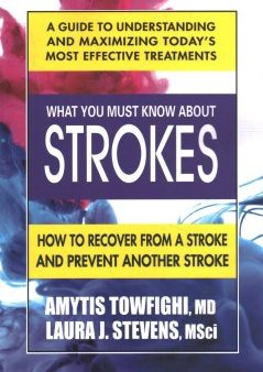 What You Must Know About Strokes Fashion